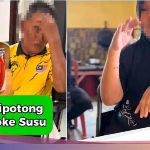 Ngeri! Dua Kaki Pria Ini Harus Diamputasi Akibat Sering Minum Soda Manis